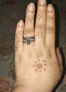 Antique Look Rings From Forever 21