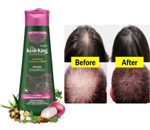 Kesh King Organic Onion Shampoo 300ml