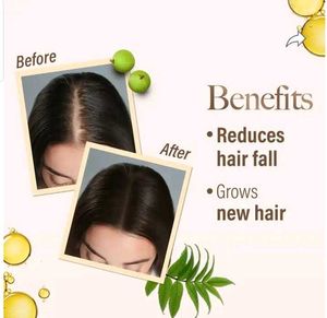 Kesh King Ayurvedic Hair Oil
