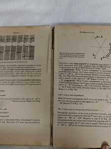 Electrocardiography Introduction