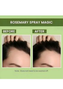 Fresh Rosemary Water For Hair Growth