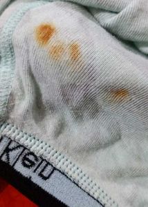 CK Patterned Boxer Briefs