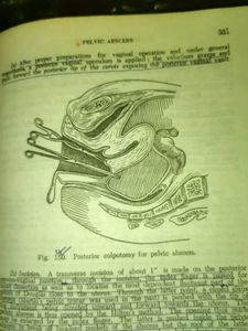 🛑 Grab unused Cusco speculum Gynae-Obs books