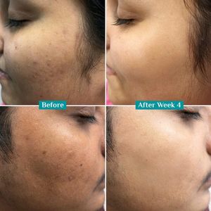 10% Vitamin C Face Serum Pilgrim 🧡🍊✨