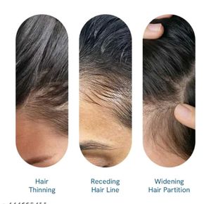 Bodywise Hair Growth Serum
