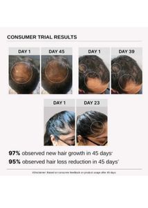 Bare Anatomy Hair Growth Serum