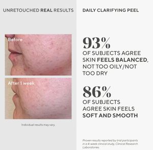 Murad Clarifying Aha Bha Peeling Solution
