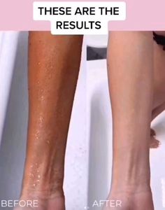 Fairness Cream 100% Results Money Back Gurantee If
