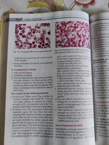 Concise Haematology Textbook