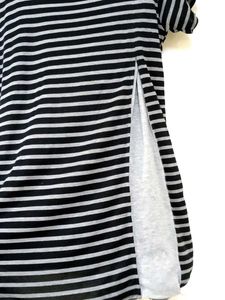 Striped Top with Button Detail