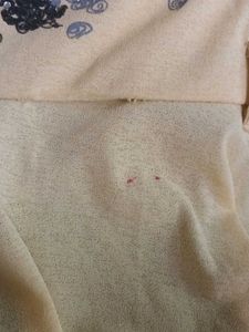 A Cotton Blend Fabric Dress, Yellow Color