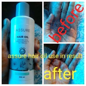 Assure Hair Oil And Shampo