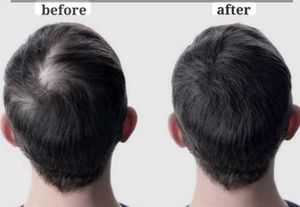 Natural Ayurvedic Hair Oil