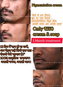 Night Cream With Soap Brightening 100%effective