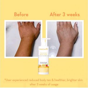 Wishcare Detan Combo - Sunscreen SPF 50 &amp; 10% AHA