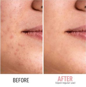 RENEE Snail Mucin Serum