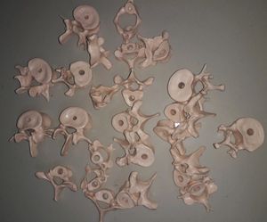 Bone Set-3 (Vertebras + Sacrum) For Medicals!!✏