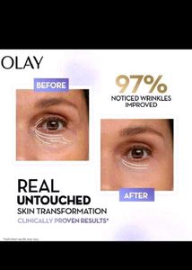 Olay Retinol Face Serum