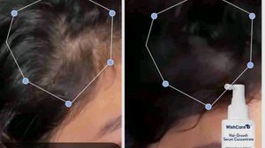 Wishcare Hair Growth Serum