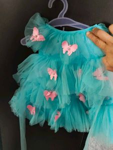 baby frock