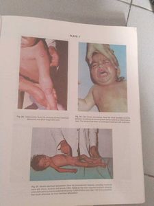 The Short Textbook of PEDIATRICS