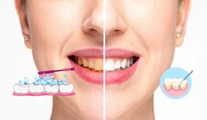 Dabur Babool Toothpaste for doctor choice in healt
