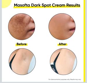 Dark Spot Reduction Cream.