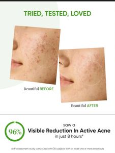Dot $ Key Cica Spot Corrector Gel