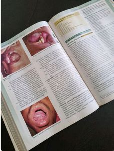Ent Pl Dhingra Book Latest Edition(8th) Mbbs
