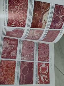 Textbook of Pathology