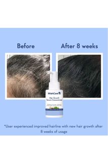 WishCare Hair Growth Serum Combo (3pieces)