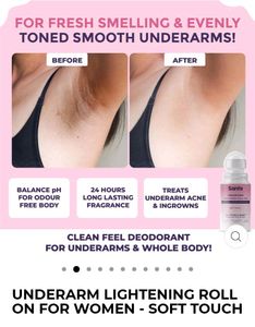 Underarm Lightening Roll On Combo Pack Of 2 💚