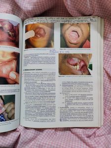 ENT book By Dr Dhingra