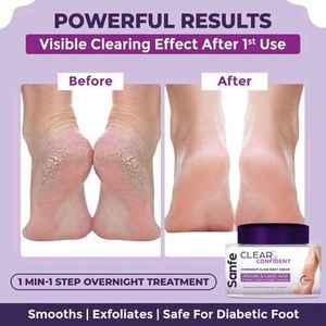 Sanfe Clear &amp; Confident Dry and Cracked Feet Cream