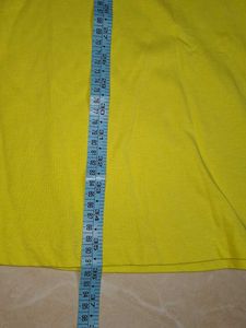 Yellow Striped Casual Dress