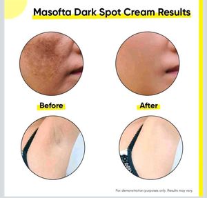 Masofta Dark Spot Reduction Cream