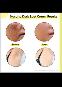 Masofta Dark Spot Cream
