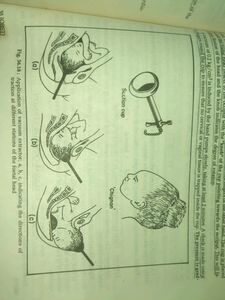 🛑 Grab unused Cusco speculum Gynae-Obs books
