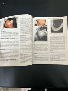 EAR, NOSE, THROAT TEXTBOOK