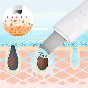 Blackhead &amp; Whitehead Remover