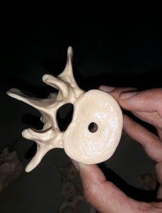 Bone Set-3 (Vertebras + Sacrum) For Medicals!!✏