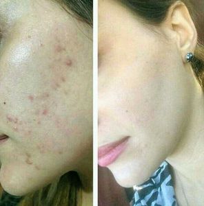Bridal Glowing Skin Whitening Cream