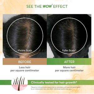 WOW Rosemary Biotin Hair Oil