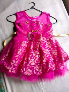 baby frock