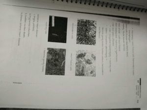 Pathology Vol 1 And 2  MARROW Edition 6