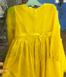 Yellow 🟡 Frock 💛