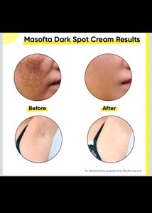 Masofta Dark Spot Reduction Cream
