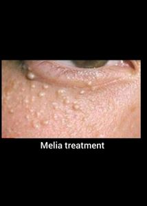 My Product 100% Result