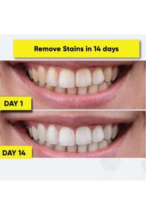 Teeth 🪥🦷 Whitening Pen 🖊️