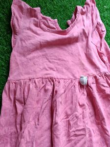 Baby Frock Daily Wear
